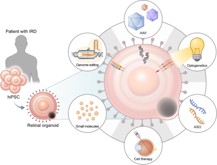 Retinal Organoids Retinal Organoids